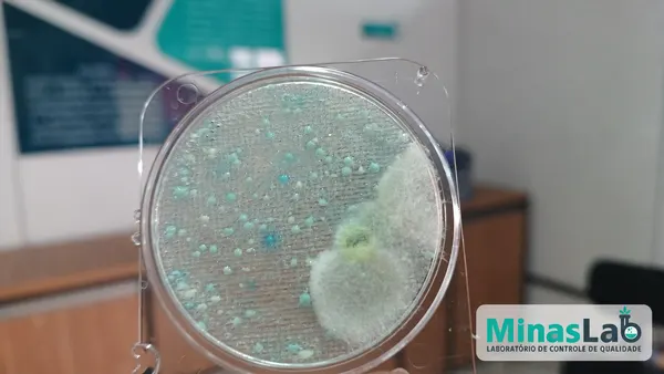 Detalhes da rotina microbiológica